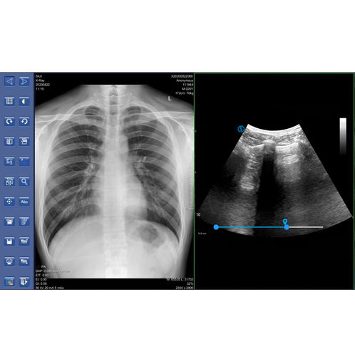 aparelho_de_radiografia_porttil_mis_10_siui_3_20251014111838_0a262daf5018.jpg